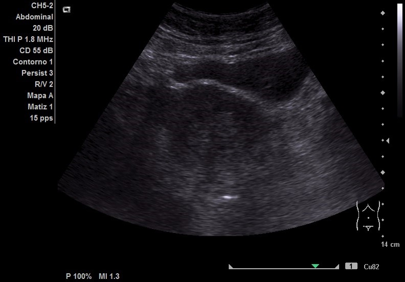 EcoC2-2-3