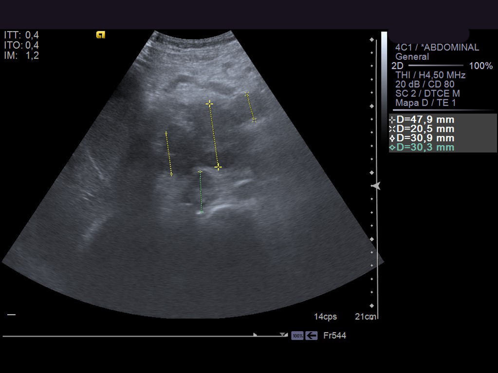 EcoC5-2_5.jpg