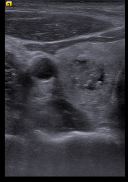 EcoC6-2_2