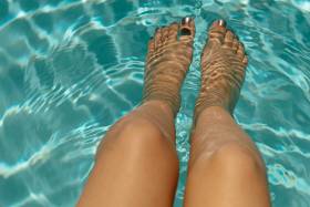 PIERNAS HINCHADAS EN VERANO