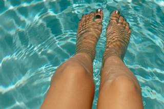 PIERNAS HINCHADAS EN VERANO